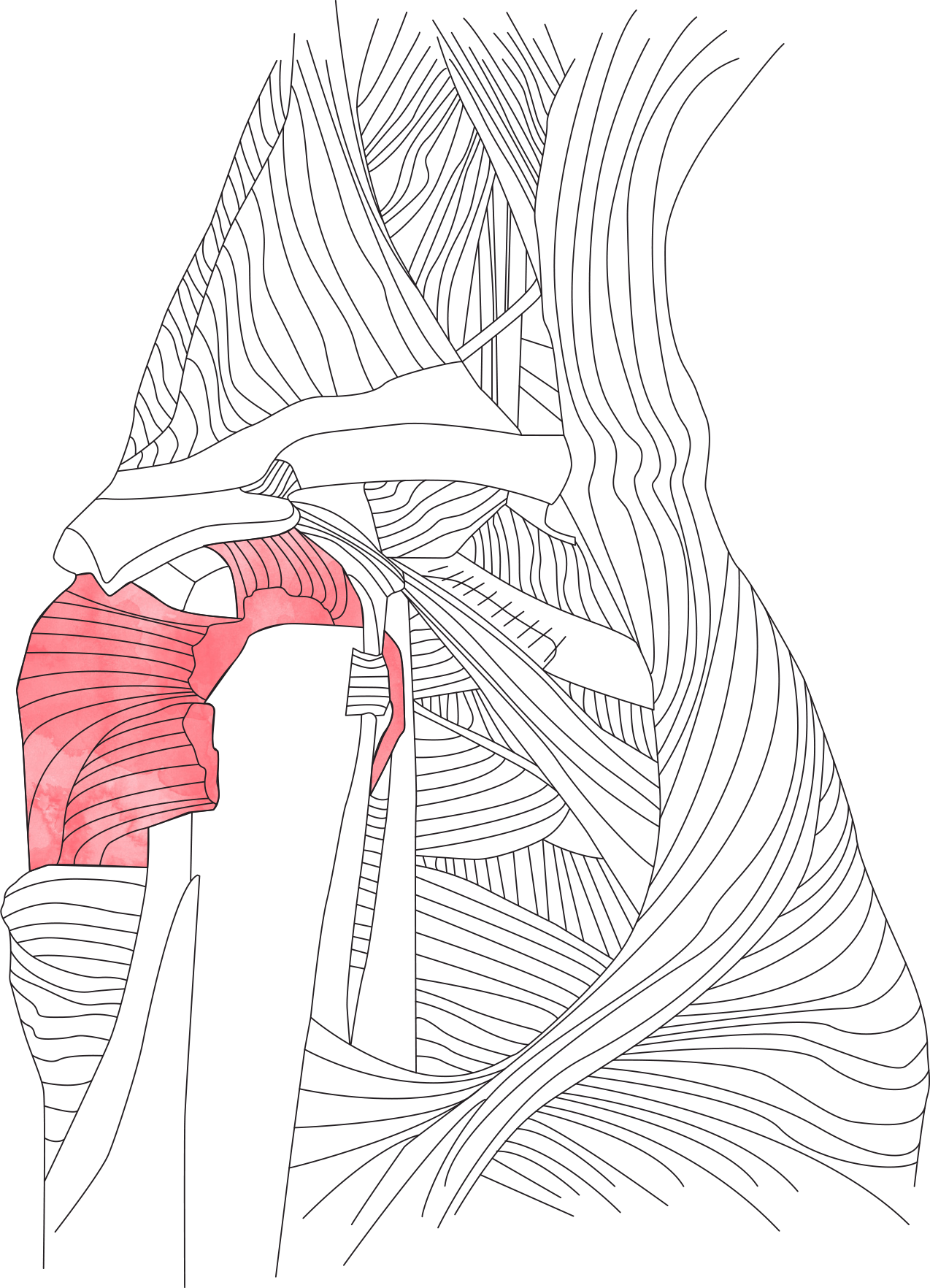 0013_Shoulder-Tendonitis-